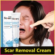 Scar Removal Cream Acne Treatment Blackhead Burns Old Scars Scald Cesarean Stretch Marks Whitening Firming Lifting Repair Cream Non irritating Moisturizing Skin Care
