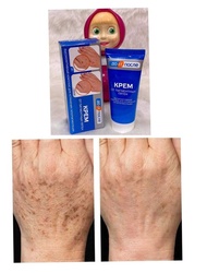[ CHÍNH HÃNG }Kem Trị Đồi Mồi Đốm Nâu Da Tay Kpem Hàng Nga.