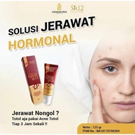 Acne Spot Sr12 | Powerful Acne Spot Cream