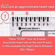 honeybird ECG 7 Step Ruler, ECG Ruler Plastic Ruler Measuring Tool, ECG 7 Step Ruler For ECG/EKG Int