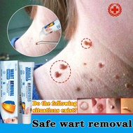 Wart Remover Ointment 20g ketuat remover Warts removal cream Kutil removal Ubat buang ketuat tahi la