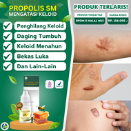 Propolis Asli Original - Obat Keloid Menonjol Tahunan Bekas Luka Menonjol Keloid Daging Tumbuh Keloi