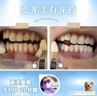 藍光美白牙齒
