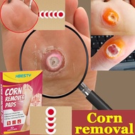 Ubat Ketuat Tapak Kaki Wart Remover Pads Foot Corn Removal Plaster Corn Remover Pads Penampal Ketuat