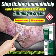 1minutes to relieve itching Antifungal cream Eczema cream Relieve itching in 1 minute Ubat kurap gat