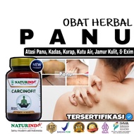 obat panu obat panu paling ampuh asli obat panu kadas kurap paling ampuh obat panu paling ampuh perm