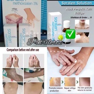 ABG Obat Vitiligo Soralen / ampuh mengatasi belang putih dikulit pigmen kulit berlebihan