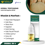 Obat Kaki Rayapan Dan Bau, Mata Ikan Di Telapak Kaki, Kapalan Di Tangan, Kulit Kering, Pecah Pecah,