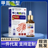 Jiazhou Wart Health Care Liquid Ordinary Euro Flat Euro Neck Meat Pellets Special for Fatal Life Min