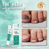 Nail Treatment Fungal Antibacterial Fungisol Antifungal Cream Nail Fungus Fepair Treatment	 Fungus N