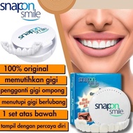 Terbaru Bisa Cod Snap On Smile 100% Original Authentic / Snap On Smile
