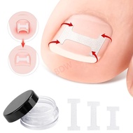BDW Ingrown Toenail Corrector Strips Brace Ingrown Toenail Correction Stickers  Glues Toenail Correc