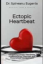 Navigating Ectopic Heartbeats: Understanding, Diagnosis, and Personalized Management