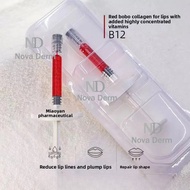 1ml Hyaluronic acid Filler ha lip filler Tulip Lip Filler Semi.Contour Shaping (Such As Lip Peaks, L