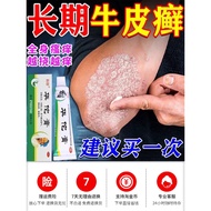 Cowhide Ointment Skin Disease Special Itching Fundamental Infection Itching Anti-Itching Antibacteri