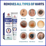 Warts Removal Cream – Skin Tag Remover, Mole Repellent – Painless & Effective