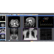 (WIN) Sante DICOM Viewer Pro 14.2.3