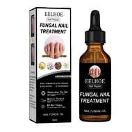 เซรั่มซ่อมแซมเล็บ nail fungus medicine ยาแก้เชื้อราที่เล็บ ยากันเชื่อราเล็บ บำรุงเล็บเสีย（น้ำมันบำรุ