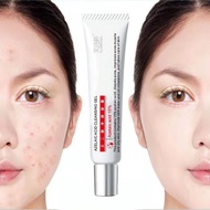 7 DAYS 15% Azelaic Acid Acne Cream To Remove Acne Marks And Repair Acne Scars Artifact Oil Control Treatment 15%壬二酸祛痘膏