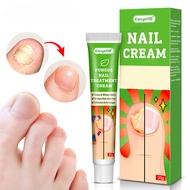 20g Grey Finger Nail Cream Inhibits Fungi Preventing Nail Thickening Cracking Infection Deep Repairi