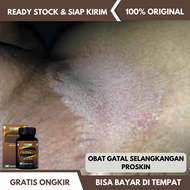 Obat Gatal Selangkangan Obat Iritasi Selangkangan Obat Selangkangan Berjamur Obat Selangkangan Hitam