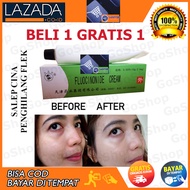 Beli 1 GRATIS 1 GoShop Salap Salep Cina ampuh Penghilang Flek Hitam Membandel Di Wajah 10 Gram