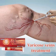 Varicose veins cream Hilangkan urat bengkak urat angin urat timbul obat urat baiki urat varicose vei