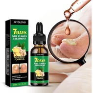 Traitement Ongles,Traitement Des Champignons à Ongles à 7 Jours,Traitement Ongles, Champignon Ongles