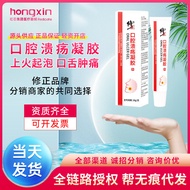 Nice Correct Oral Ulcers Gel Fire on Tongue Sore Foaming Prosthesis Gum Swelling Create Facial Pain 