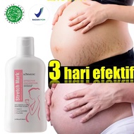 Stretch Mark Cream 200ML Penghilang Bekas Luka Bekas Penghilang Bekas Luka Krim Stretch Stretch Mark
