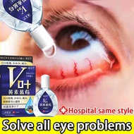 LISA  Eye Drops For Dry Eye Astigmatism Eye Drops eye drop japan 15ml Lutein relieves dry eye syndro