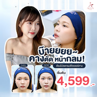 ฟิลเลอร์คาง หน้าเรียวไม่ง้อแอป Alyn clinic