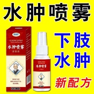 Edema spray for lower limb edema in elderly people with edema and swelling feet swe水肿喷雾下肢水肿老人水肿浮肿脚肿下