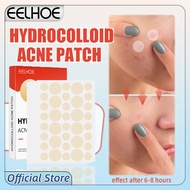 EELHOE Hydrocolloid Acne Patch 144pcs 痘痘贴 Acne Patch Hydrogel Acne Patch Remove Acne Pimple Patch Fa