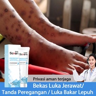 Krim hilangkan parut hitam Hilangkan parut kaki krim parut kaki Penghilang bekas luka hitam Mosquito