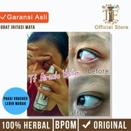 MERAH MATA Eye Medicine Eye Irritation Medicine Red Eye Medicine Minus Eye Medicine Cataract Eye Med