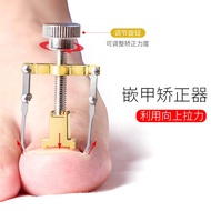 Nail Corrector Ingrown Nail Corrector Inflammation Hook Toenail Curling Nail Corrector Pedicure Toen