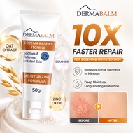 Krim Gatal Kulit Krim Eczema 50g Psoriasis Cream Antibacterial Anti Itch Relief Skin Care Eczema Cre