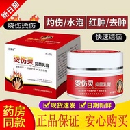 Burn Burn Burn Burn Cream Hot Oil Boiling Water Burn Burn Electric Welding Burn Burn External Use Ad