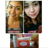 ♞,♘,♙Dr Alvin rejuvenating Set Skin Care Toner Sunscreen Sunblock Kojic Soap Made with Legit Doctor