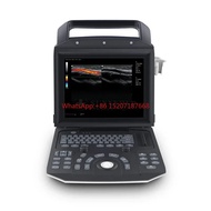 SYA-M5 Portable Medical Color Doppler Ultrasound Zoncare M5 Laptop Ultrasound System