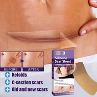 Silicone Scar Tape Silicone Scar Sheet Scar Removal Patch Keloid Scar Plaster Stretch Mark Removal S