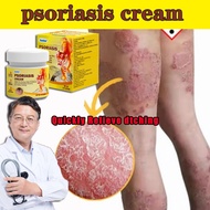 ⚘Psoriasis Cream Antifungal cream Eczema cream Cream gatal kulit 20g krim gatal kulit herba cina Uba