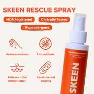 SKEEN Rescue Spray - 100ml | Flare Up | Sensitive Skin | Itchy & Angry Skin