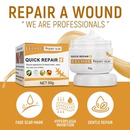 Scar Removal Cream Skincare Repair Blackhead Acne Spots Acne Scar Treatment Treats Acne Scars, Burns