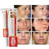 Whitening And Spot Removing Cream, Niacinamide, Whitening And Spot Removing, Spot Fading, Moisturizi