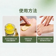 [Ready Stock] Anti-Itch Cream Anti-Itch King Anti-Itch Cream Mosquito Repellent Anti-Itch Cream Anti