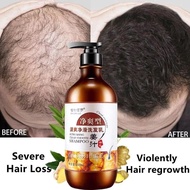 植物保罗防脱生姜洗发水🇲🇾Plant Paul Anti-hair loss ginger shampoo