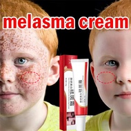 Pekas Remover Very Effective Whitening Freckle Remover Cream Niacinamide serum remove dark spots on 