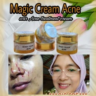 krim parut kudis magic cream ance (scar treatment)